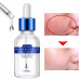 Сыворотка для лица гиалуроновая Rorec Precious Hydra B5 Essence c витамином В5 (15 мл) Сыворотка для лица гиалуроновая Rorec Precious Hydra B5 Essence c витамином В5 (15 мл)